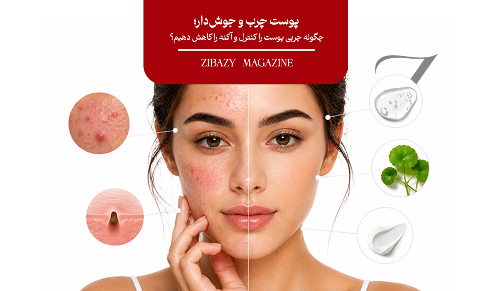 پوست چرب و جوش‌دار؛ چگونه چربی پوست را کنترل و آکنه را کاهش دهیم؟